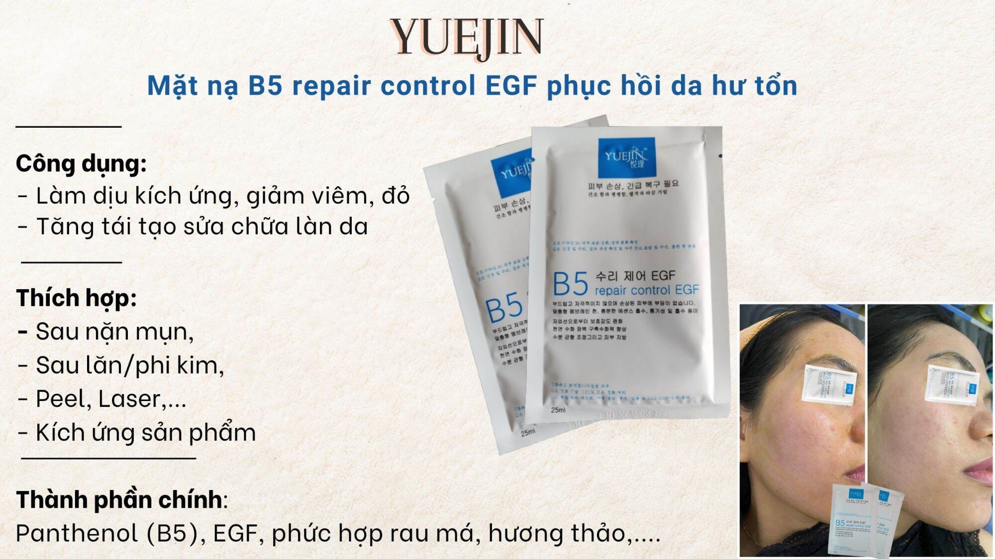 Mặt nạ cấp ẩm phục hồi da B5 Yuejin Repair Control EGF 1